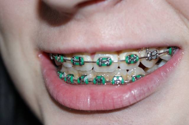 service-img04 service-img04